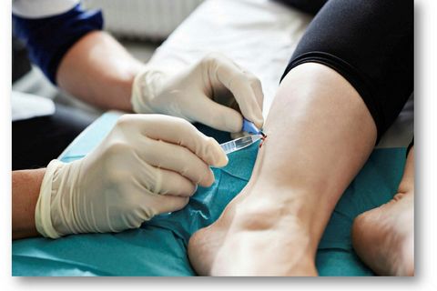 Páll Ragnar Karlsson developed a method for collecting skin samples from diabetics.